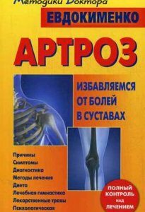 Артроз. Избавляемся от болей в суставах