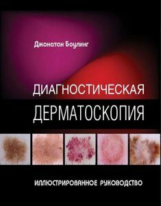 Диагностическая дерматоскопия. Иллюстрированное руководство - Боулинг Дж. (978-5-91839-106-8)