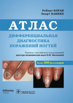Дифференциальная диагностика поражений ногтей : атлас - Роберт Бэран