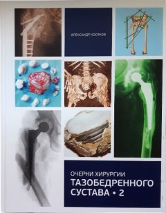 Очерки хирургии тазобедренного сустава - Косяков А. (978-966-97400-3-8)