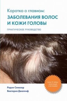 Коротко о главном: заболевания волос и кожи головы - Синклер Р.